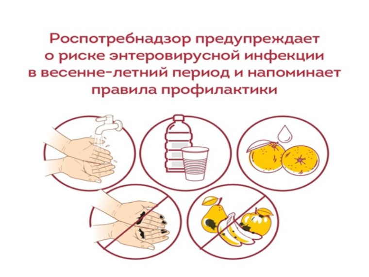 Профилактика энтеровирусной инфекции.